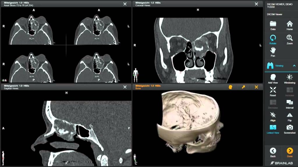 DICOM viewer Android