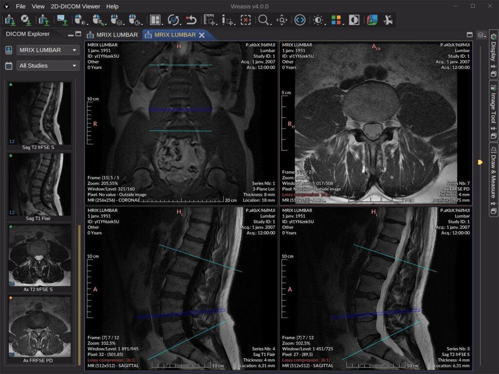 Visor DICOM les online