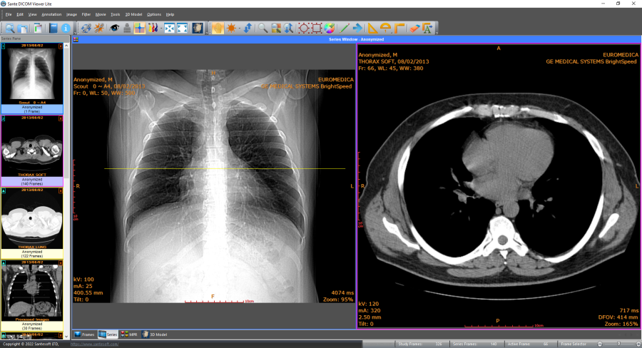 Visor DICOM les online